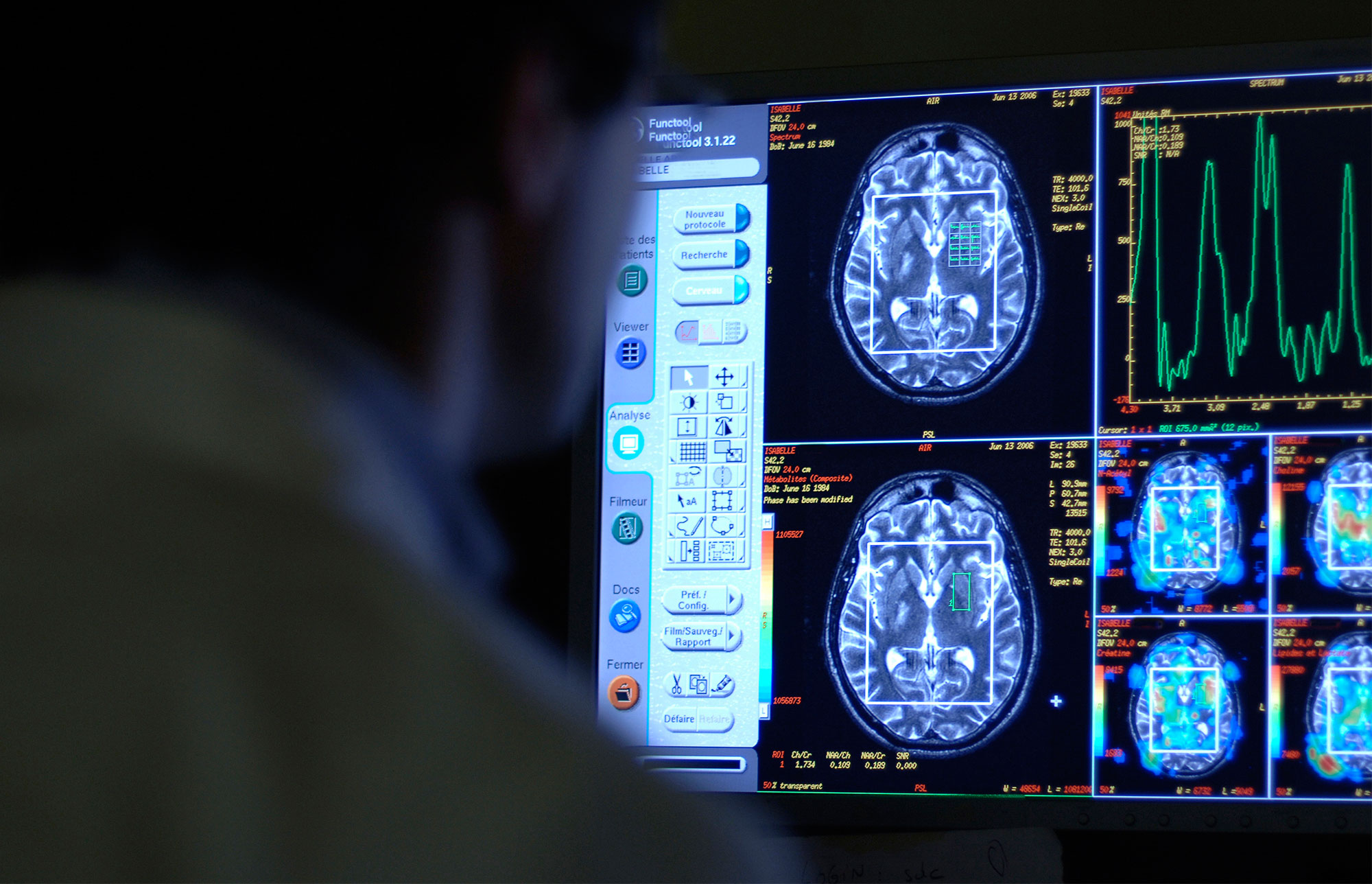 Caltech Research News: Altered Perceptions