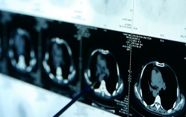 New Caltech Research Provides Insight into How the Brain Works to Recall Memories