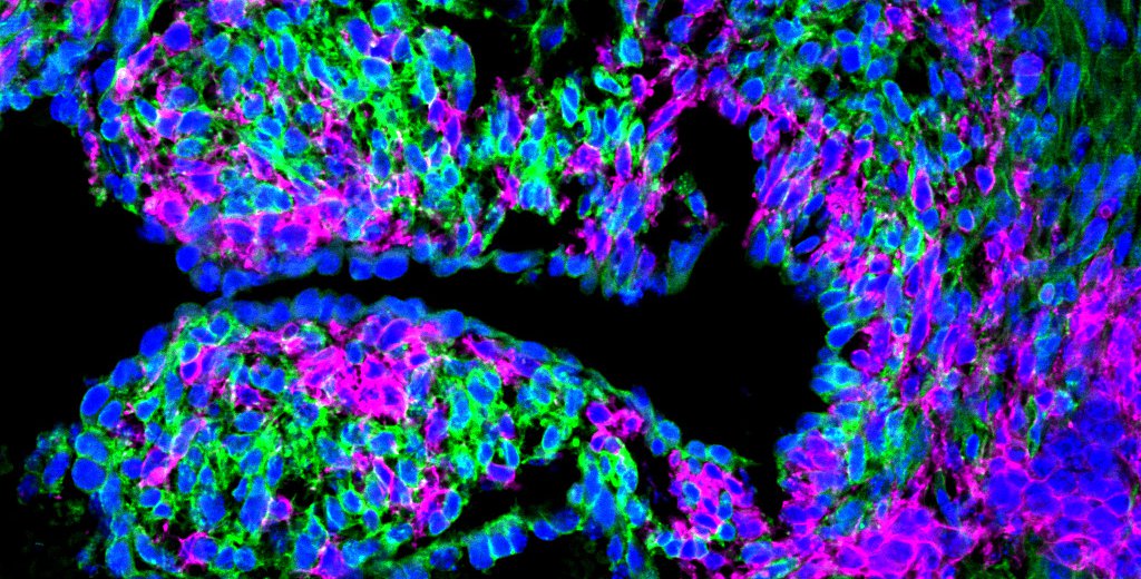 Mending Broken Hearts with Neural Crest Cells