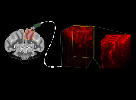 Reading Minds with Ultrasound: A Less-Invasive Technique to Decode the Brain’s Intentions