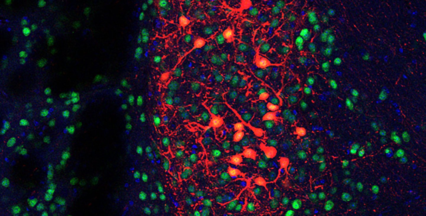 Identifying the Neural Link Between Gut Bacteria and Social Behavior in Mice