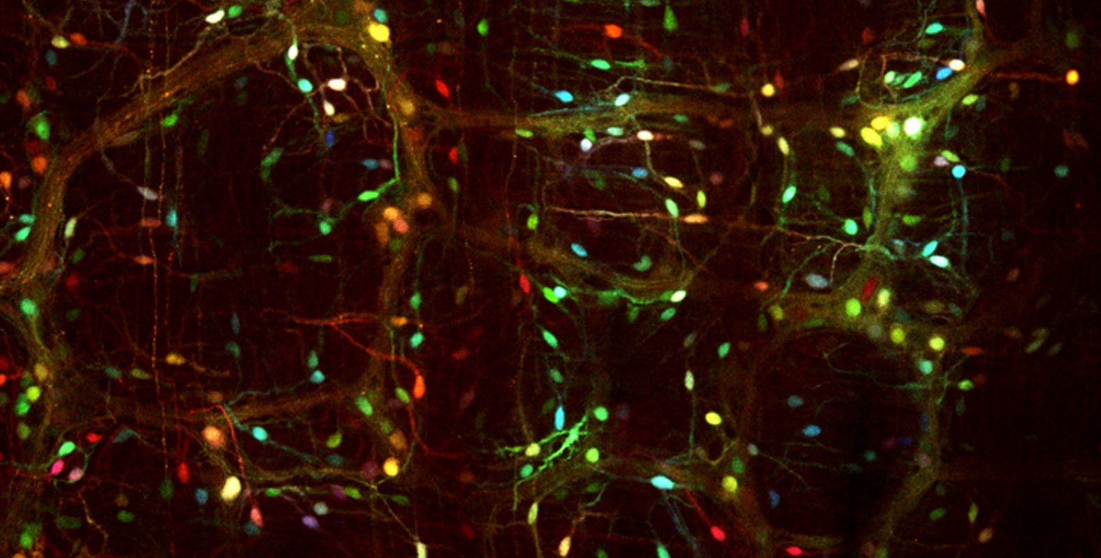 Caltech Researchers Team Up to Fight Parkinson’s Disease