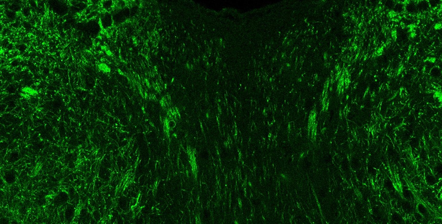 A Microbial Compound in the Gut Leads to Anxious Behaviors in Mice