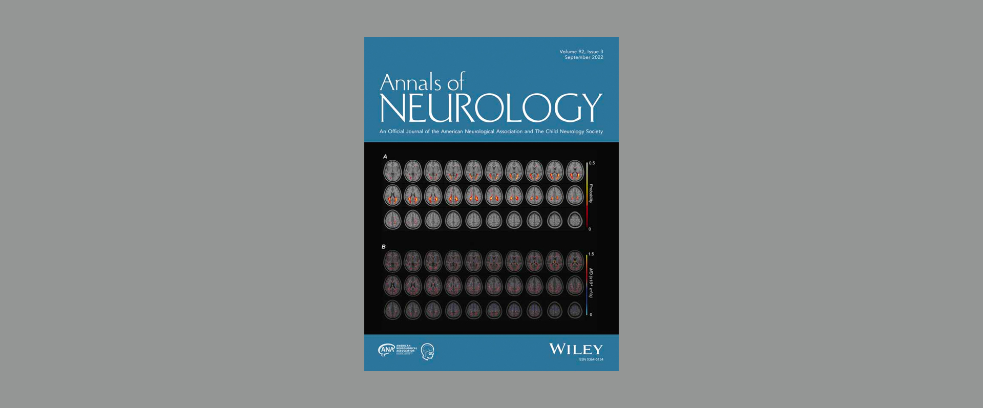 TCCI Investigator Jintai Yu’s Team Reveals Distribution and Risk Factors of Alzheimer’s Disease Continuum in Northern Chinese Han Population