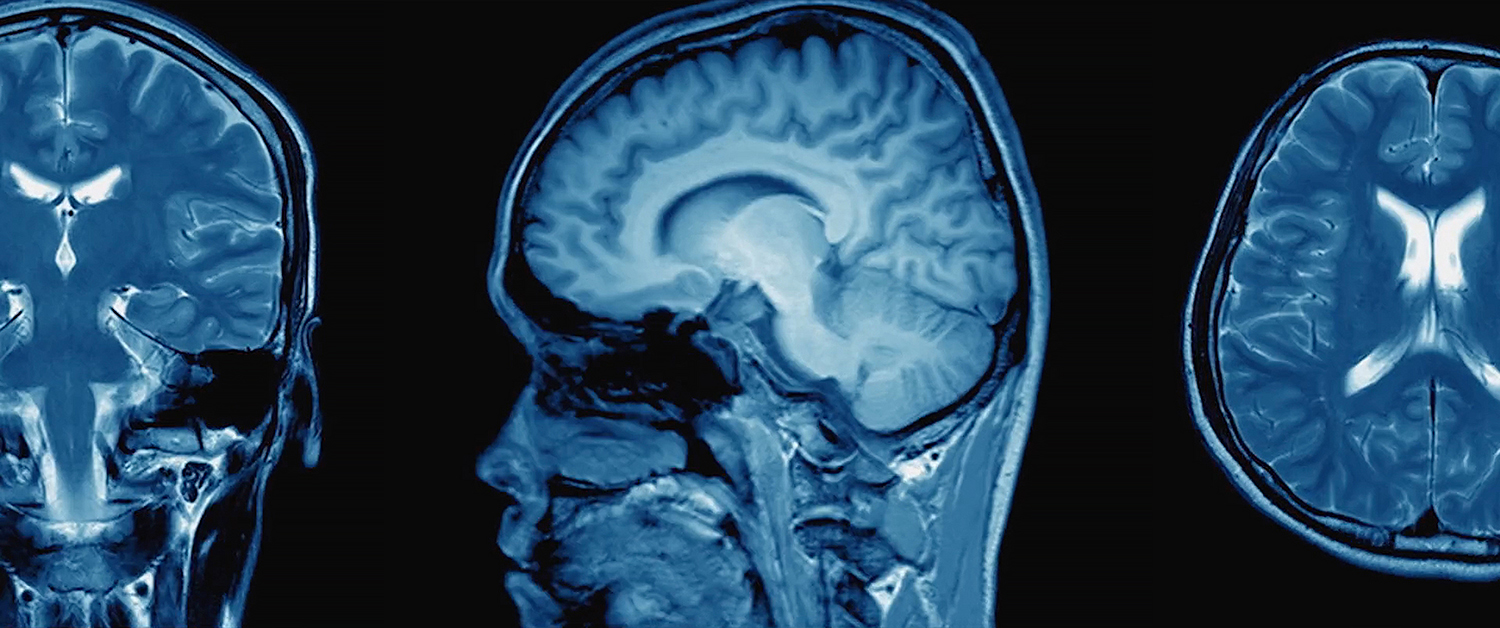 China’s First Brain Science Documentary Goes Viral, Highlighting TCCI’s Achievements