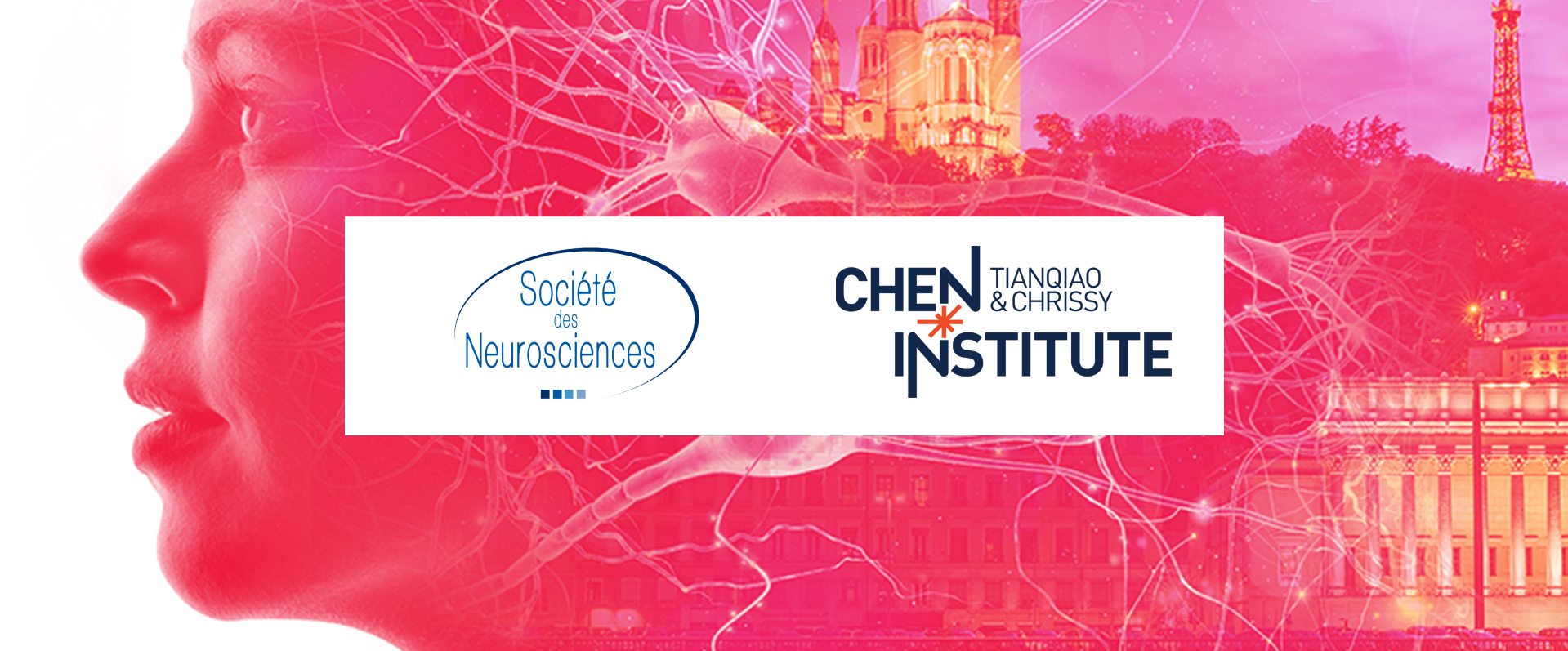 NeuroFrance 2023 Cassandre Vielle Thesis Report