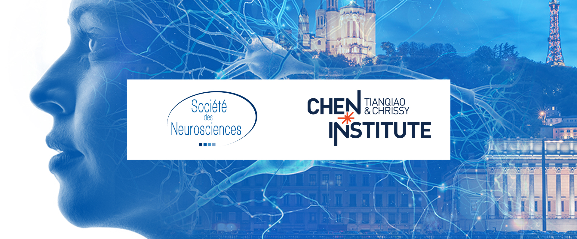 NeuroFrance 2023 Sabine Adeline FANTA YADANG Thesis Report