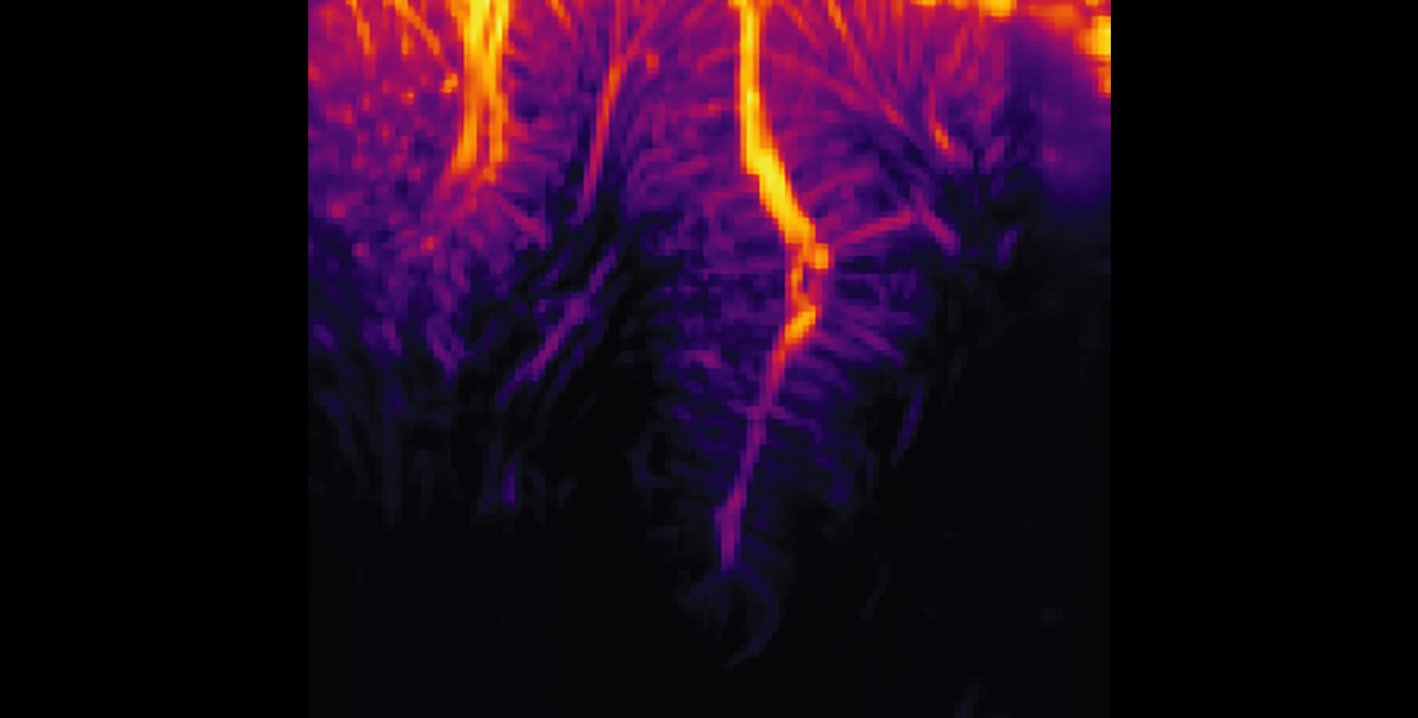 Ultrasound Enables Less-Invasive Brain–Machine Interfaces