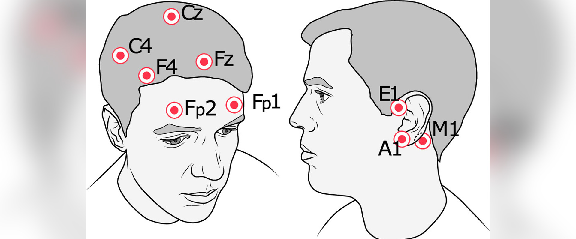 Detection of common EEG phenomena using individual electrodes placed outside the hair